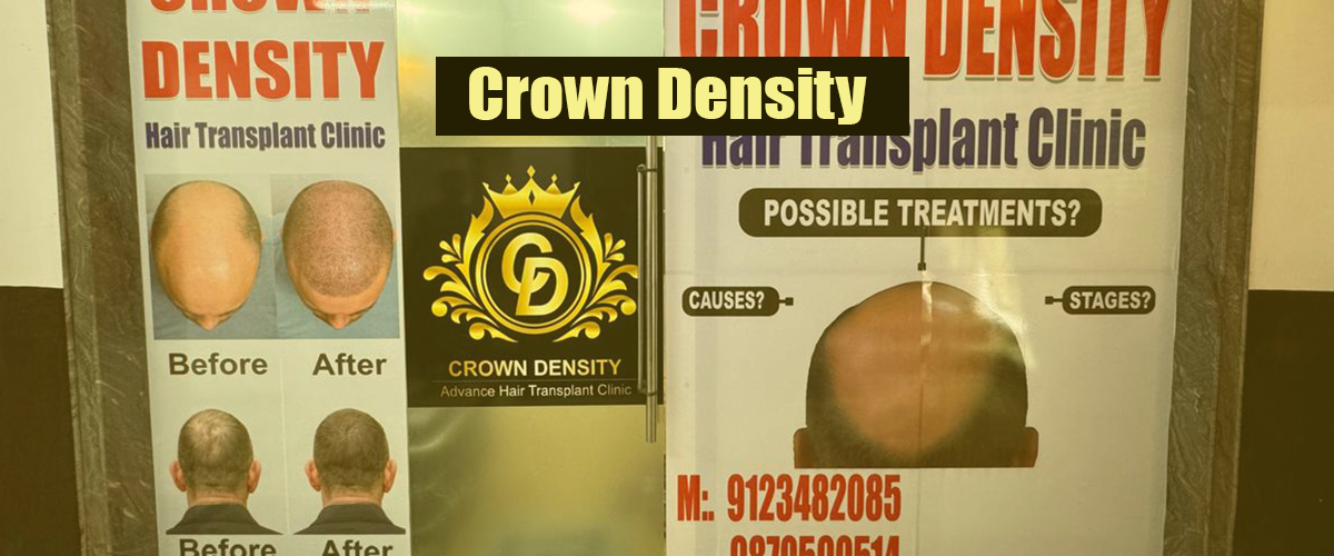 Beard Hair Transplant in Noida